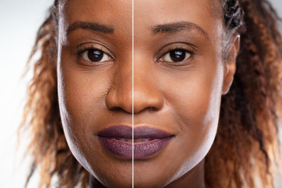 Anti-aging